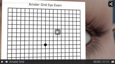 Video: Amsler Grid