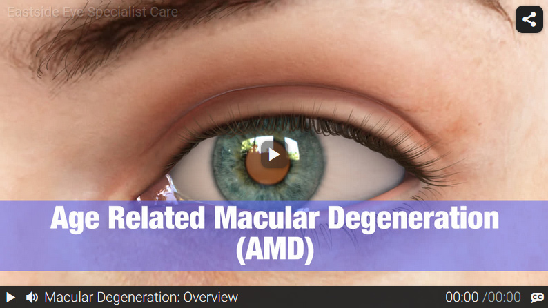 Video: Age Related Macular Degeneration