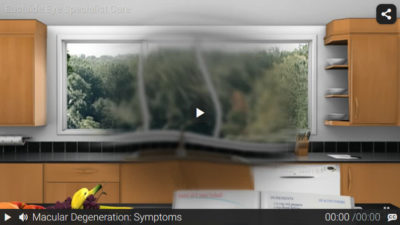Video: Macular Degeneration Symptoms