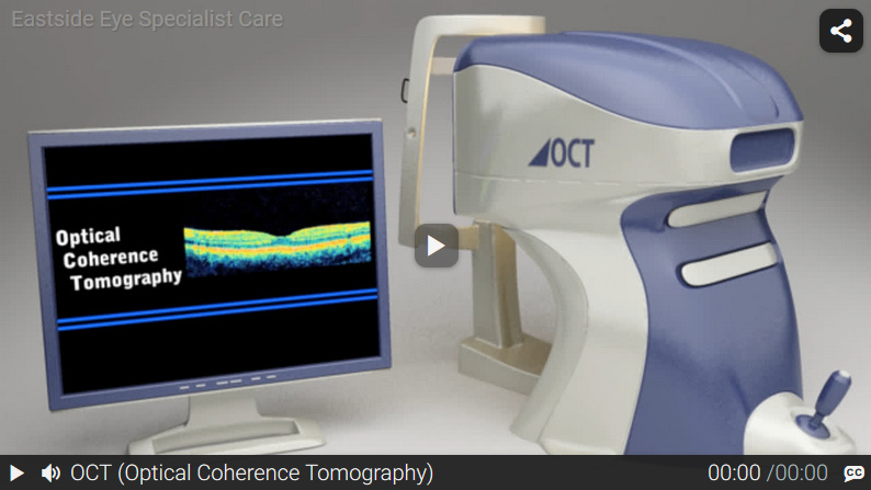 Video: Optical Coherence Tomography