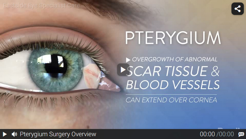 Video: Pterygium Surgery Overview