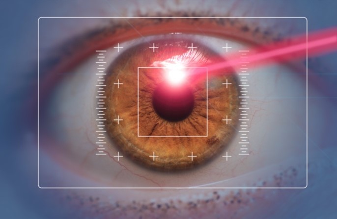 Laser eye correction fees in Brisbane